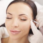 Essayez les injections de Botox :